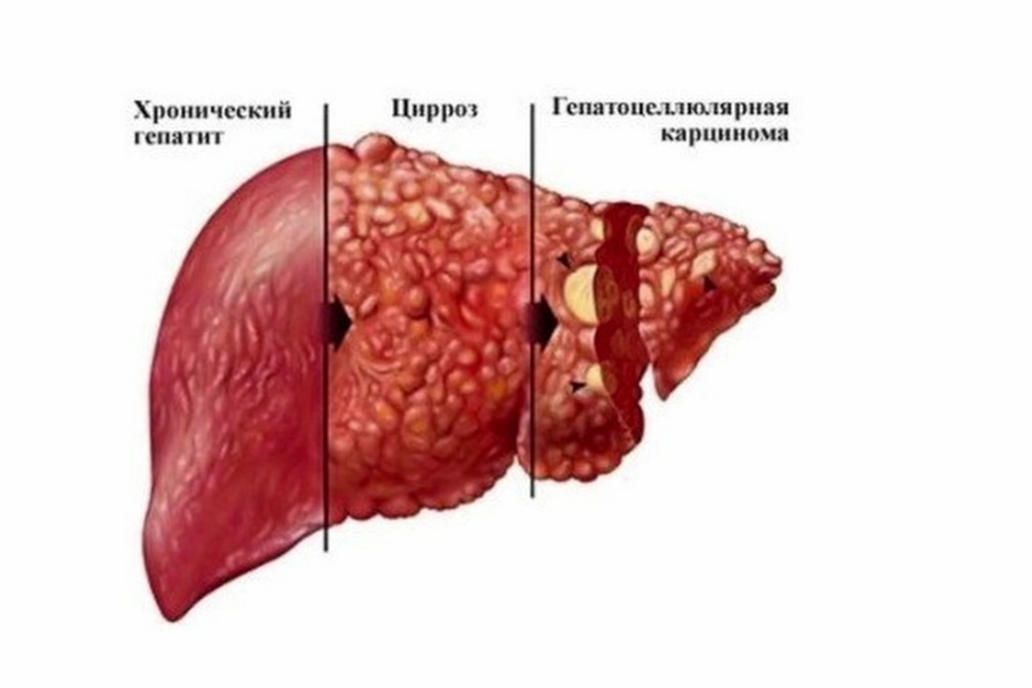 Эластография печени. Роль метода в диагностике заболеваний печени