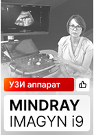 Видеоотзыв на УЗ аппарат Mindray Imagyn i9 (Нагорнева С.В.)