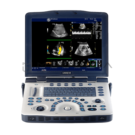 GE Healthcare LOGIQ V2, 2