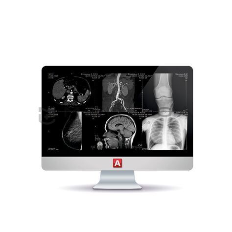 Medray PACS/RIS АПК АрхиМед