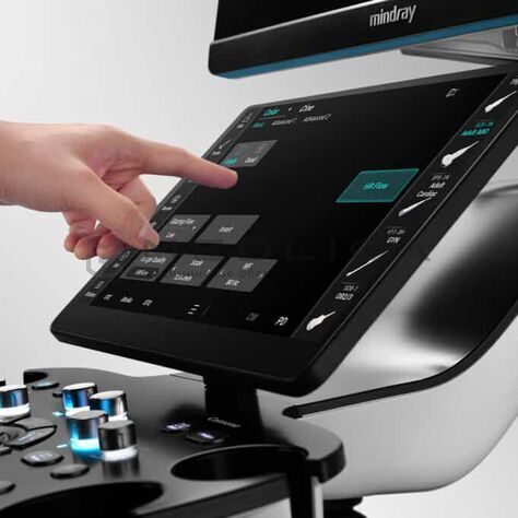 Mindray Consona N9, Сегмент: Частный, 6